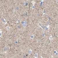 HPA IHC Cerebral cortex — TMIGD2