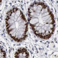 HPA IHC Colon — WDHD1