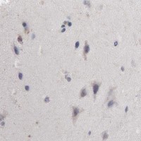 HPA IHC Cerebral cortex — WDHD1
