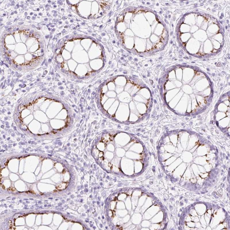 SDF4 Antibodies The Human Protein Atlas