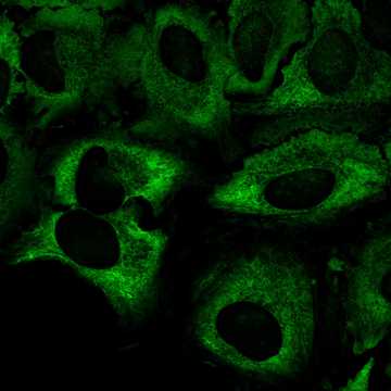 HPA011311: HeLa 
