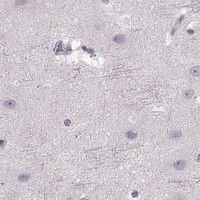 HPA IHC Cerebral cortex — CCNA2