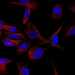 CAB000115: U-251MG