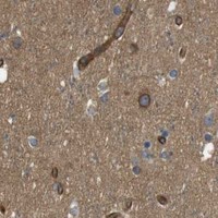 HPA IHC Cerebral cortex — TSC1