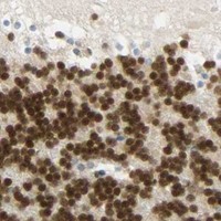 HPA IHC Cerebellum — POLB