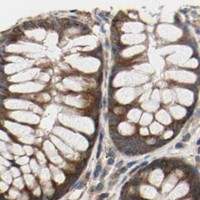 HPA IHC Colon — USP9X