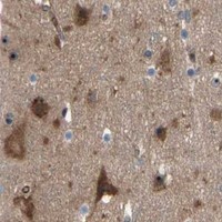 HPA IHC Cerebral cortex — USP9X