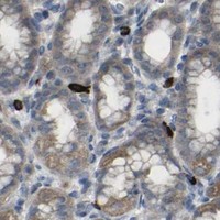 HPA IHC Stomach — CCR10