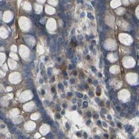 HPA IHC Colon — CCR10