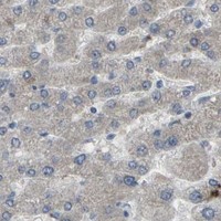 HPA IHC Liver — CCR10