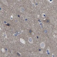 HPA IHC Cerebral cortex — CCR10