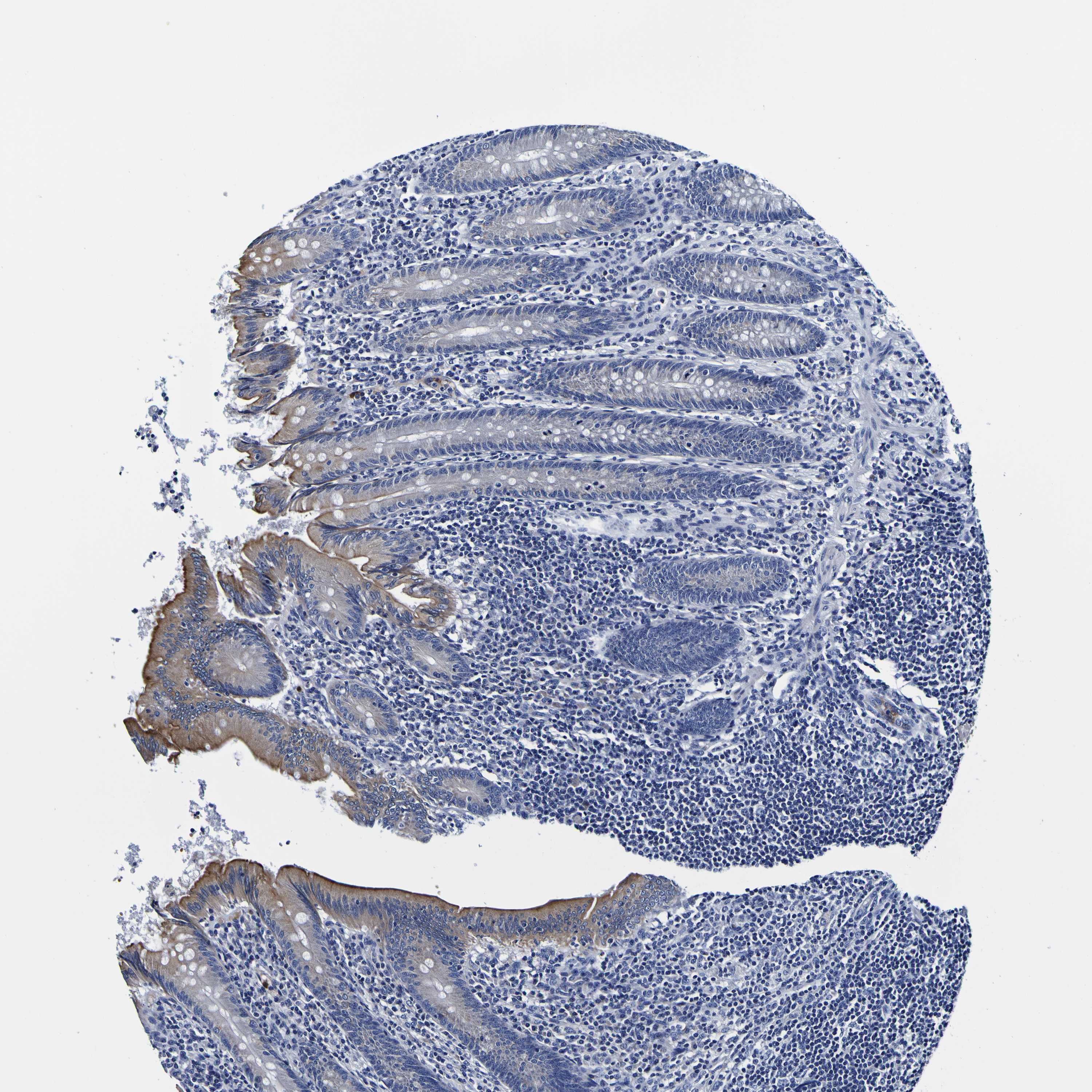 Tissue expression of PDLIM4 Staining in appendix The Human Protein