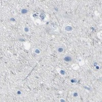 HPA IHC Cerebral cortex — ACSL1