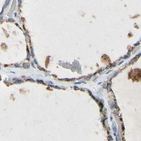 HPA IHC Thyroid gland — ACADL