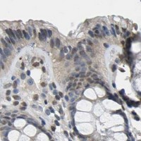 HPA IHC Colon — ERBB4