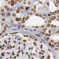 HPA IHC Kidney — SUN2