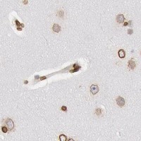HPA IHC Cerebral cortex — SUN2