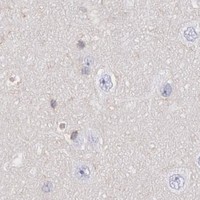 HPA IHC Cerebral cortex — SNAP23