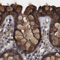 HPA IHC Colon — NANOS1