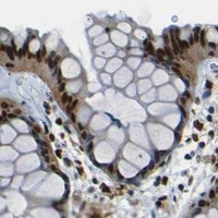 HPA IHC Colon — HMGN1