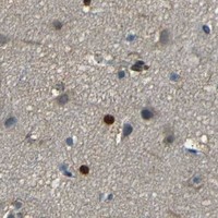 HPA IHC Cerebral cortex — HMGN1
