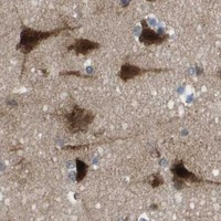 HPA IHC Cerebral cortex — AXIN2