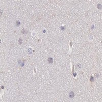HPA IHC Cerebral cortex — LYN
