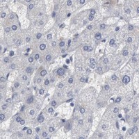 HPA IHC Liver — DMC1