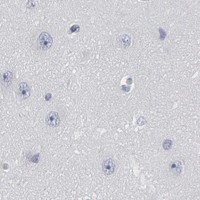 HPA IHC Cerebral cortex — DMC1
