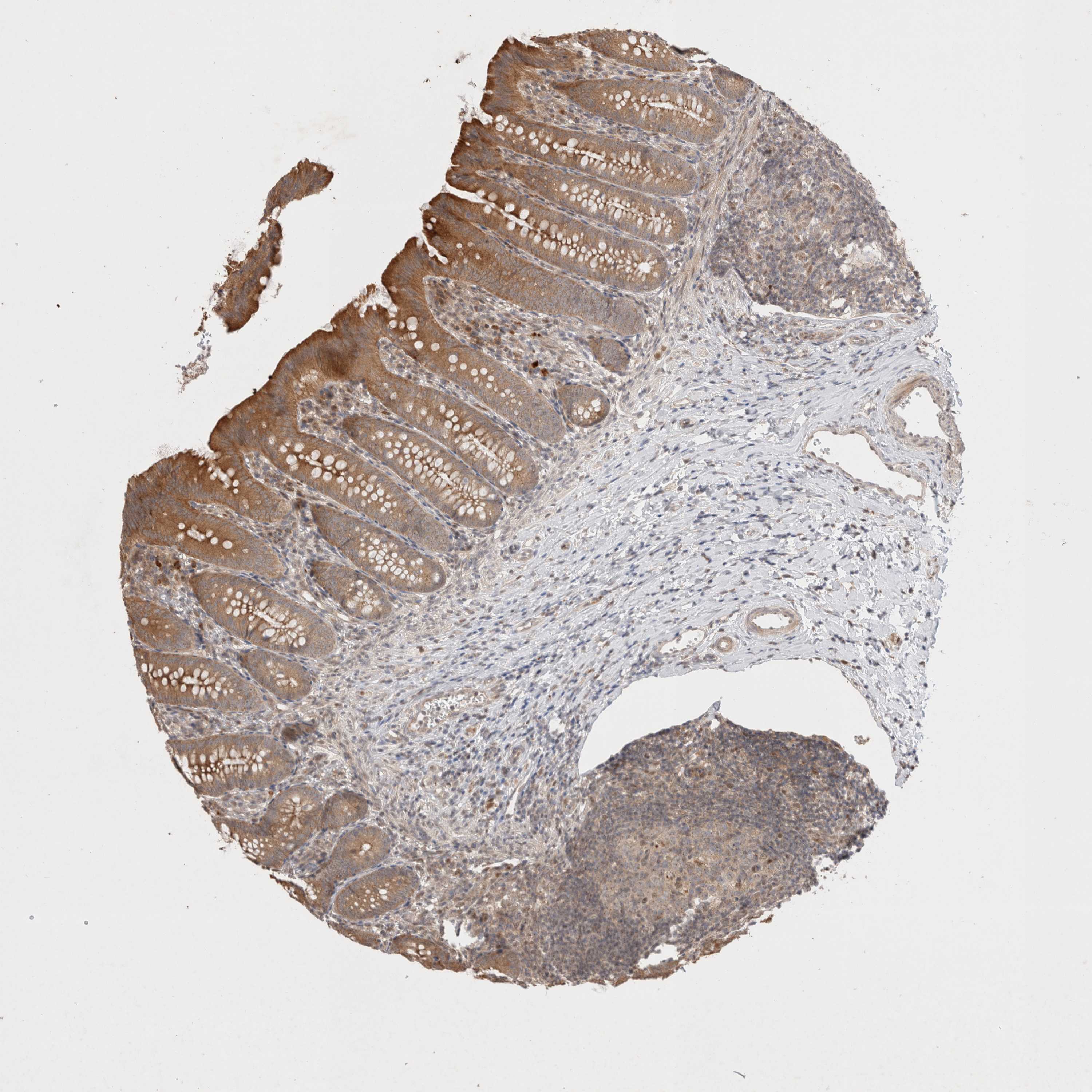 Tissue expression of SLC29A1 Staining in appendix The Human Protein