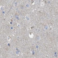 HPA IHC Cerebral cortex — BTN3A1