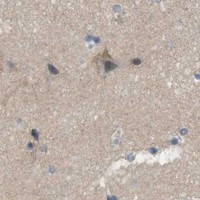 HPA IHC Cerebral cortex — PVR