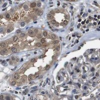 HPA IHC Kidney — UBXN1