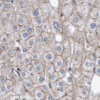 HPA IHC Liver — NECTIN2