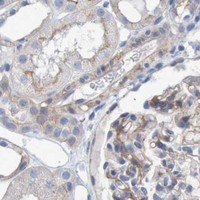 HPA IHC Kidney — NECTIN2