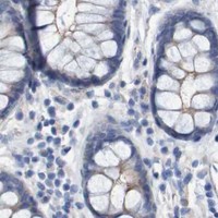 HPA IHC Colon — NECTIN2