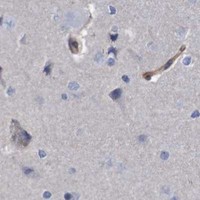 HPA IHC Cerebral cortex — NECTIN2