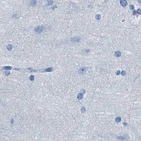 HPA IHC Cerebral cortex — ASGR1