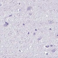 HPA IHC Cerebral cortex — CTSE