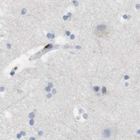 HPA IHC Cerebral cortex — F2R