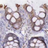 HPA IHC Colon — FRMD6