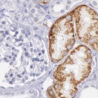 HPA IHC Kidney — FRMD6