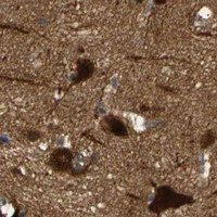 HPA IHC Cerebral cortex — SKP1