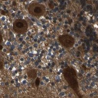 HPA IHC Cerebellum — SKP1