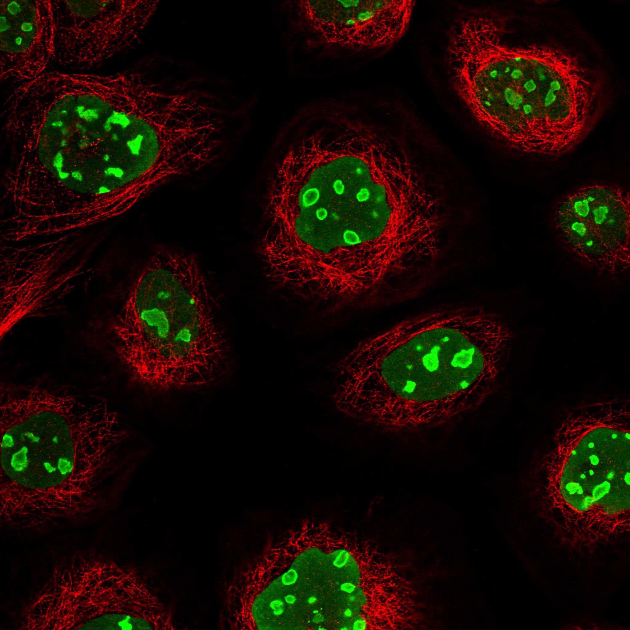 Cell atlas - NPM1 - The Human Protein Atlas