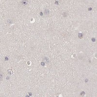HPA IHC Cerebral cortex — ZFP36L1