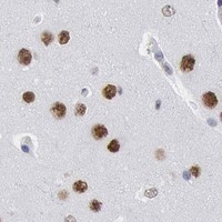 HPA IHC Cerebral cortex — SUB1