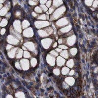 HPA IHC Colon — SPTBN1