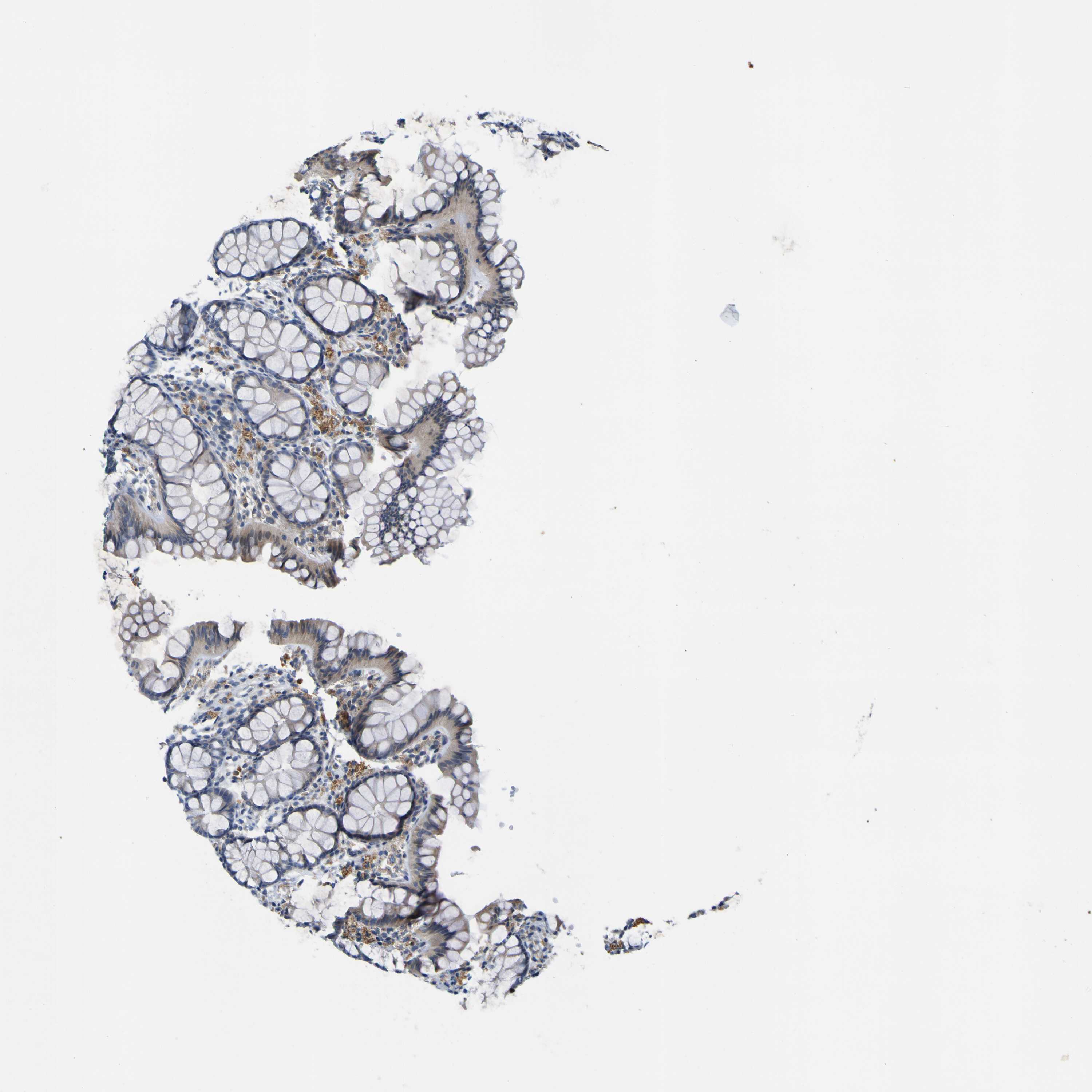 Tissue expression of LDLR Staining in colon The Human Protein Atlas