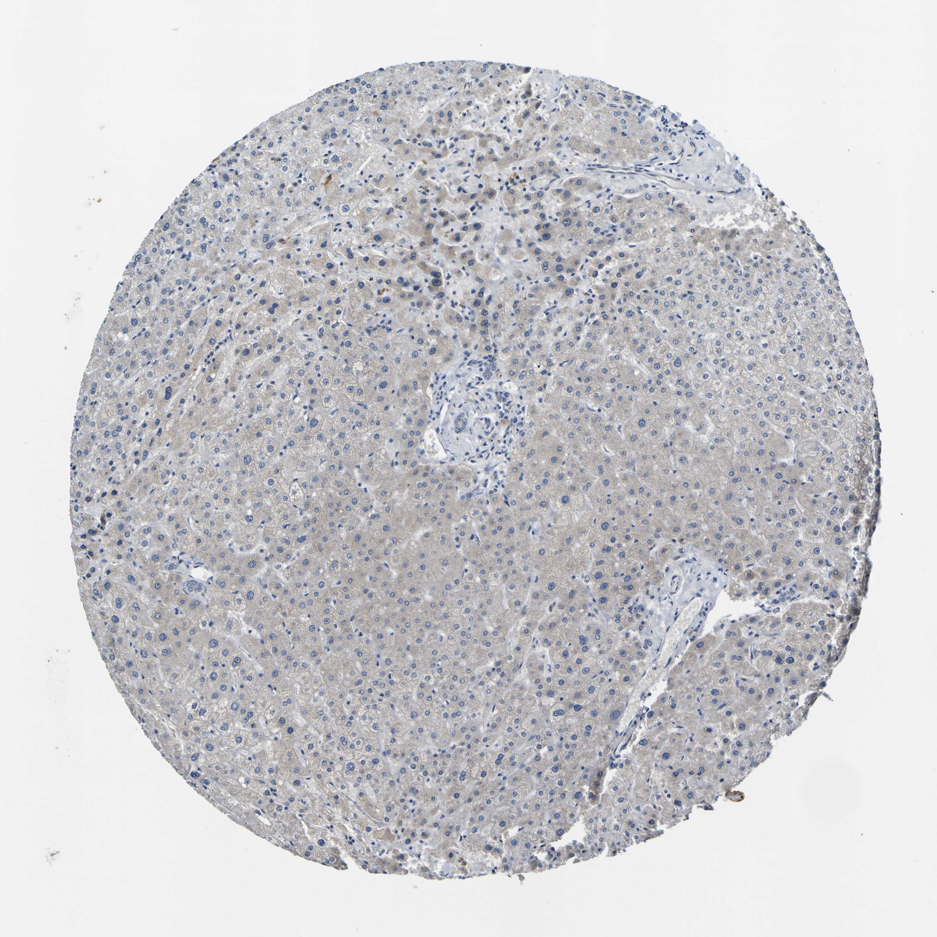 Tissue expression of LDLR Staining in liver The Human Protein Atlas
